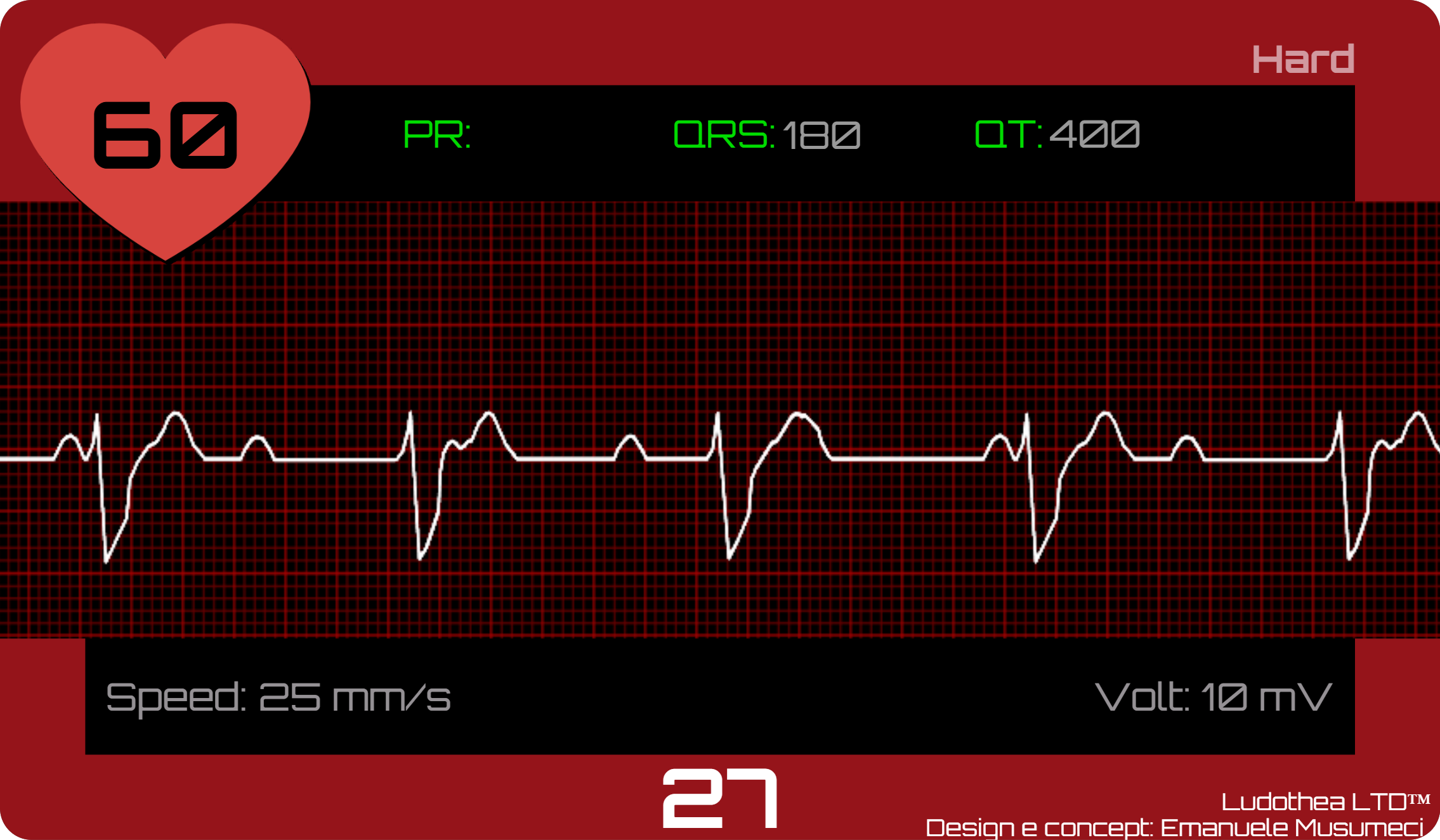 ECG Race hard-level rhythm card showing third-degree AV block