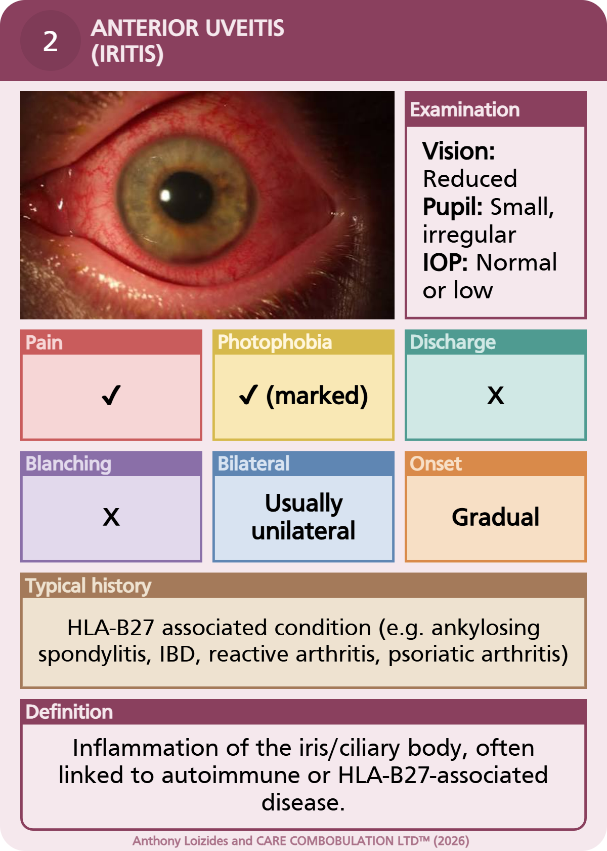 Red-Eyed prototype card: anterior uveitis, credited to Anthony Loizides and CareCombobulation